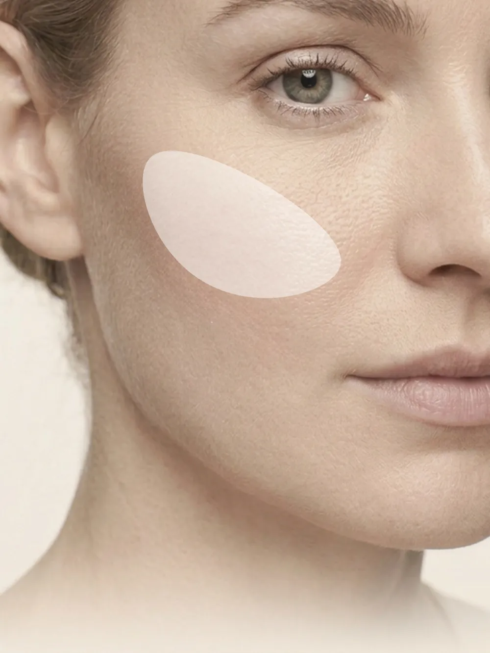 Cheek Implant
