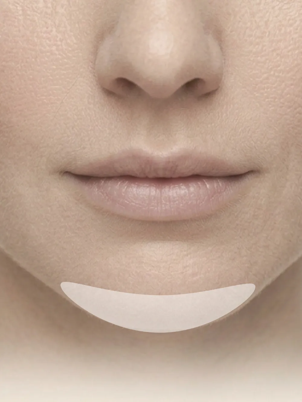 Chin Implant